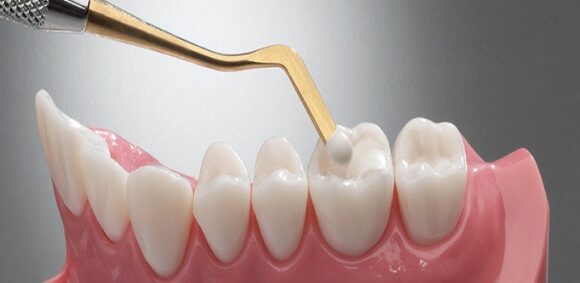 Treatments – Agar Dental